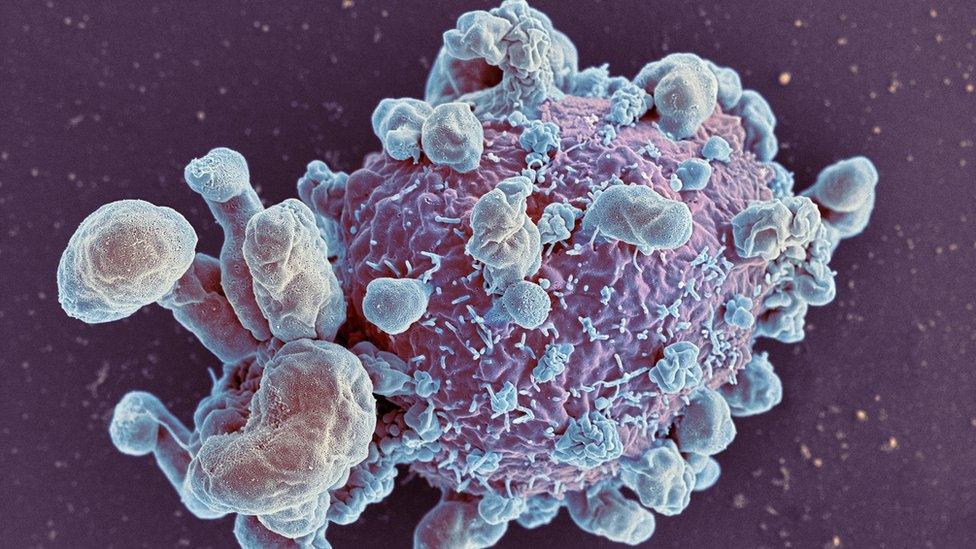 Tumor Classification Project